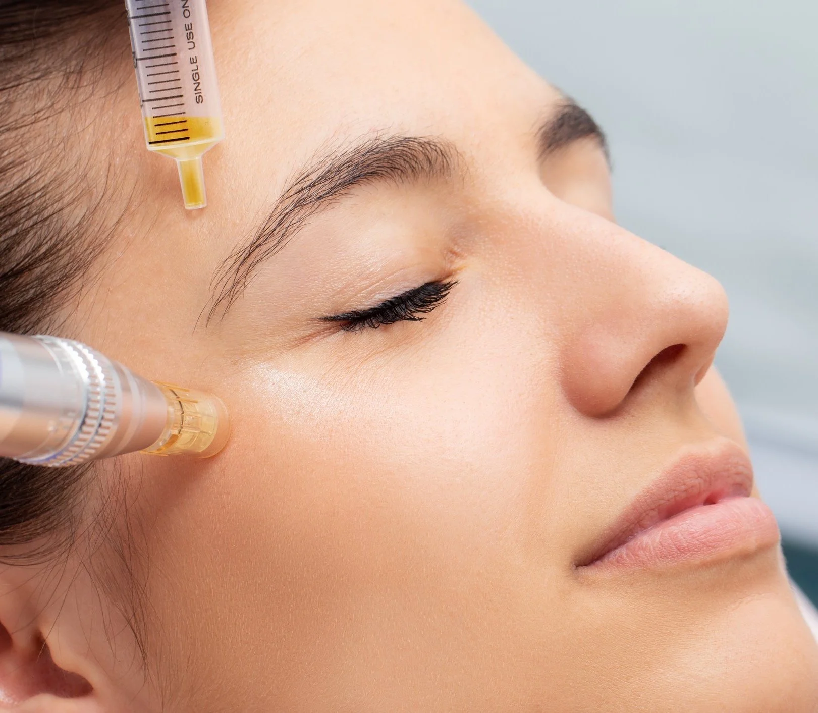 Dermapenle Prp Yüz Germe Dermapenle Prp Yüz Germe